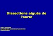 Dissections aiguës de l'aorte MEDECINE D'URGENCE 07-08.ppt