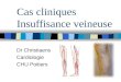 Cas cliniques Insuffisance veineuse Dr Christiaens Cardiologie CHU Poitiers