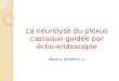 La neurolyse du plexus cœliaque guidée par écho-endoscopie Nancy Ibrahim R 2