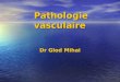 Pathologie vasculaire Dr Glod Mihai. Oedème Lœdème est une augmentation de la quantité d'eau dans les espaces extra-vasculaires. Aspect macroscopique