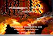 Pathologies liées aux vibrations Vibrations transmises aux membres supérieurs au corps entier