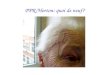 PPR/Horton: quoi de neuf?. Cas clinique Homme 72 ans présentant des douleurs des épaules + MCP de rythme inflammatoire ATCD nécrose myocardique inférieure