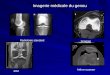 Imagerie médicale du genou Imagerie médicale du genou Radiologie standard IRM Scanner Arthro-scanner