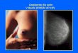 Anatomie du sein V Bazile (IFMEM AP-HP). Evolution de la glande mammaire