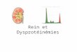 Rein et Dysprotéinémies. Dysprotéinémies = Dysglobulinémies Prolifération dun clone de cellules productrices dImmunoglobulines –Excès dIg monoclonale