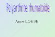 Anne LOHSE. La polyarthrite rhumatoïde Rhumatisme parfois grave, souvent sévère, qui peut conduire à linvalidité si négligé