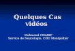 Quelques Cas vidéos Mahmoud CHARIF Service de Neurologie, CHU Montpellier