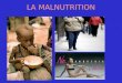 LA MALNUTRITION. La malnutrition La malnutrition désigne un état pathologique causé par la déficience ou l'excès dun ou plusieurs nutriments. L'apport
