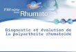 Diagnostic et évolution de la polyarthrite rhumatoïde