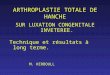 ARTHROPLASTIE TOTALE DE HANCHE SUR LUXATION CONGENITALE INVETEREE. Technique et résultats à long terme. M. KERBOULL