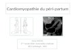 Cardiomyopathie du péri-partum Denis DOYEN 2 ème année DESC réanimation médicale DES Cardiologie - NICE