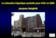 La résection hépatique partielle pour CHC en 2008 Jacques Belghiti