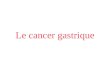 Le cancer gastrique. Epidémiologie 2°cancer digestif en France En France : 7000 cas/an. A diminué de 50% en 25 ans (modif alimentaire, réfrigération,