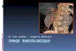 Pr Yves Gandon – Imagerie Médicale. Radiologie Radiographies Standard Avec opacification Scanner Angiographies Echographie Imagerie par résonance magnétique