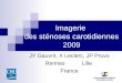 Imagerie des sténoses carotidiennes 2009 JY Gauvrit, X Leclerc, JP Pruvo RennesLille France