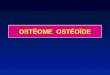 OSTÉOME OSTÉOÏDE. L'ostéome ostéoïde est une tumeur bénigne Fréquence : 10 % des tumeurs bénignes âge : adolescent et jeune (80 % < 30 ans) Prédominance