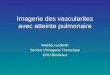 Imagerie des vascularites avec atteinte pulmonaire Mathieu Lederlin Service d’Imagerie Thoracique CHU Bordeaux