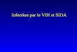 Infection par le VIH et SIDA. Immunodéficience grave liée à la déplétion et à la dysfonction des cellules immunitaires CD4 + et entraînant la survenue