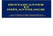 Dentascanner et implantologie