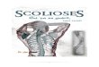 Scolioses - Dr j. Polak