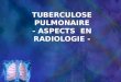 Tuberculose Pulmonaire-Aspects Radiologiques