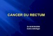 Cancer du rectum