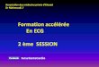 Formation accélérée en ECG - 2ème session-