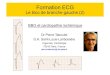ECG : BBG et cardiopathie ischemique JNUC3 5 dec 14