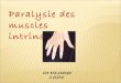 Paralysie des muscles intrinseques