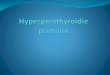 Hyperparathyroïdie primaire