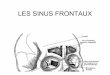 Sinus frontal