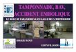 Tamponnade, bav et accident embolique