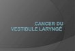 Cancer du vestibule laryng©
