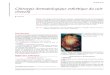 Chirurgie dermatologique esthétique du cuir chevelu.pdf