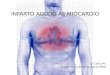 Dr Cantu ME Dr Juan Fco. Lumbreras Aguilar R2MF.  El infarto agudo de miocardio representa la manifestación más significativa de la cardiopatía isquemia,