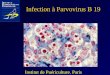 Infection à Parvovirus B 19