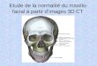 Etude de la normalité du maxillo-facial à partir d’images 3D CT