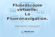 Fluoroscopie virtuelle: La Fluoronavigation