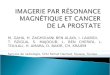 Imagerie par résonance magnétique et cancer de la prostate