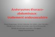 Anévrysmes  thoraco -abdominaux:  traitement endovasculaire