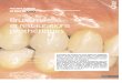 Bruxisme Et Restauration Prothétique _ Inf Dentaire 99