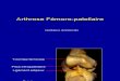 13 Arthrose Fémoro Patellaire