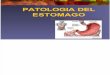 02.- Patologia Del Est Omago