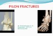 Pilon fractures