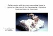 Polygraphie et Polysomnographie dans le cadre du ... documents/sas/2. BS. B. Etcheverry Fr.pdf · Définition des syndromes Troubles respiratoires nocturnes de type obstructif –