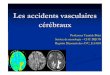 Les accidents vasculaires cérébraux - IFSI DIJON ischémique constitué: Symptomatologie durable par nécrose du tissu cérébral Signes cliniques selon localisation Hémiplégie