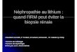 Néphropathie au lithium : quand l’IRM peut éviter la ...pe.sfrnet.org/.../pdf/2009/1/4fb839be-96ab-494e-9508-e88bcac44eee.pdf · ScientificWorldJournal. 2008 Aug 31;8:828Aug 31;8:828--9.9