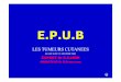 E.P.U - Epu B AMIENS(FRANCE) · • Suit les lignes de Blasko • Petits « comédons » en surface • Impression de lésion posée sur la peau? Quel est votre diagnostic? ... •