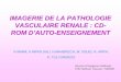 IMAGERIE DE LA PATHOLOGIE VASCULAIRE …pe.sfrnet.org/Data/ModuleConsultationPoster/pdf/2006/1/4bda05db... · imagerie de la pathologie vasculaire renale : cd-rom d’auto-enseignement
