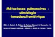 Métastases pulmonaires : sémiologie …pe.sfrnet.org/Data/ModuleConsultationPoster/pdf/2009/1/cdcc06c5-02... · Métastases pulmonaires : sémiologie tomodensitométrique Zidi